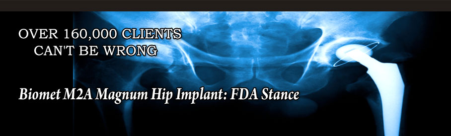 Biomet M2A Magnum Hip Implant: FDA Stance